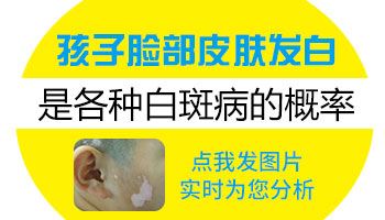 白斑猎蝽